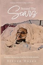Beyond The Scars