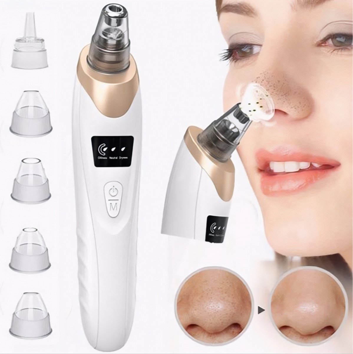 Hoge Kwaliteit Mee-Eter Verwijderen Vacuüm Gezichtsporie Reiniger Elektrische Anti Acne Bestrijden Tool 5 Sondes Voor Vrouwen En Mannen Gezicht Schoonheid