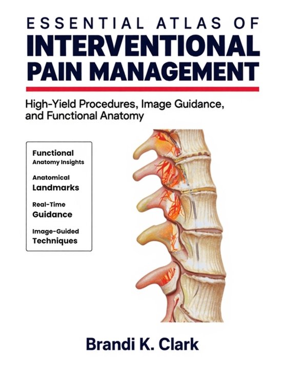 Essential Atlas of Interventional Pain Management | 9781291906479 ...