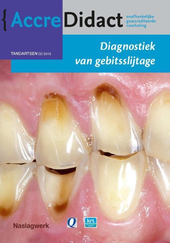 AccreDidact TA2015-2 - Diagnostiek van gebitsslijtage - Peter Wetselaar | 