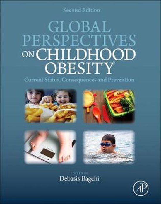 Global Perspectives on Childhood Obesity - cover
