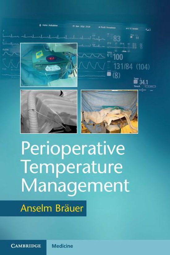 Perioperative Temperature Management - cover