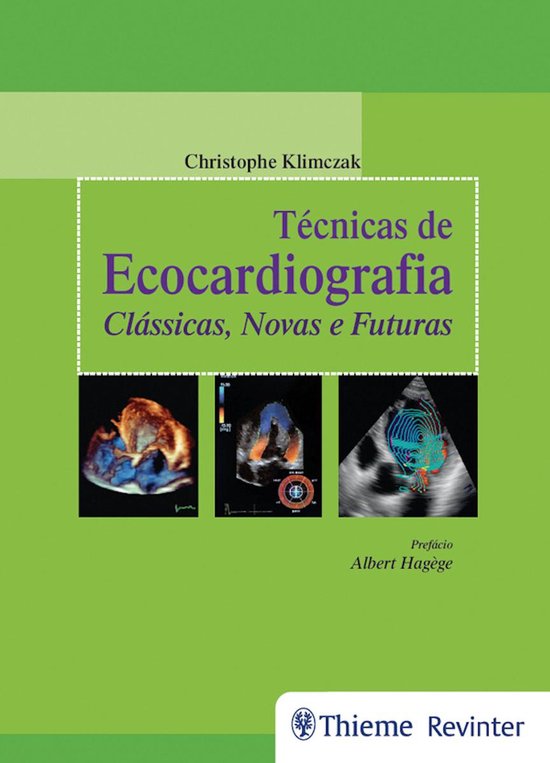 Técnicas de Ecocardiografia - cover