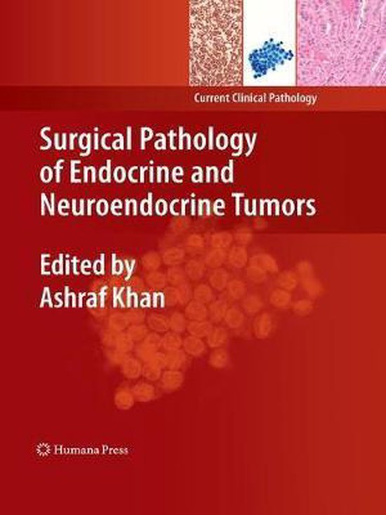 Current Clinical Pathology- Surgical Pathology of Endocrine and Neuroendocrine Tumors