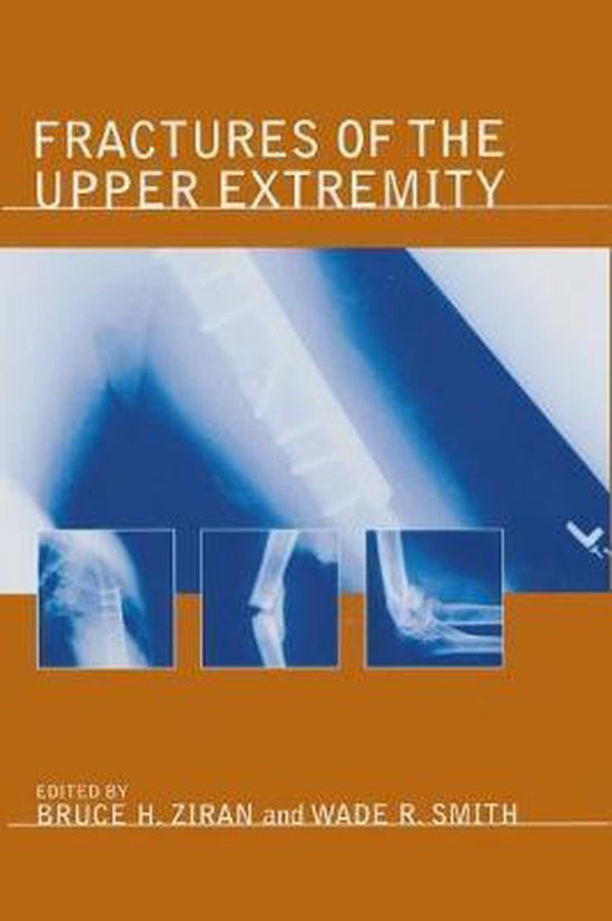 Fractures of the Upper Extremity - cover