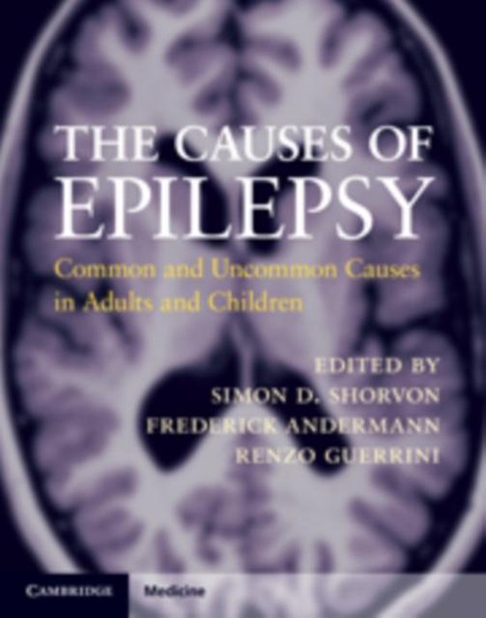 Causes Of Epilepsy