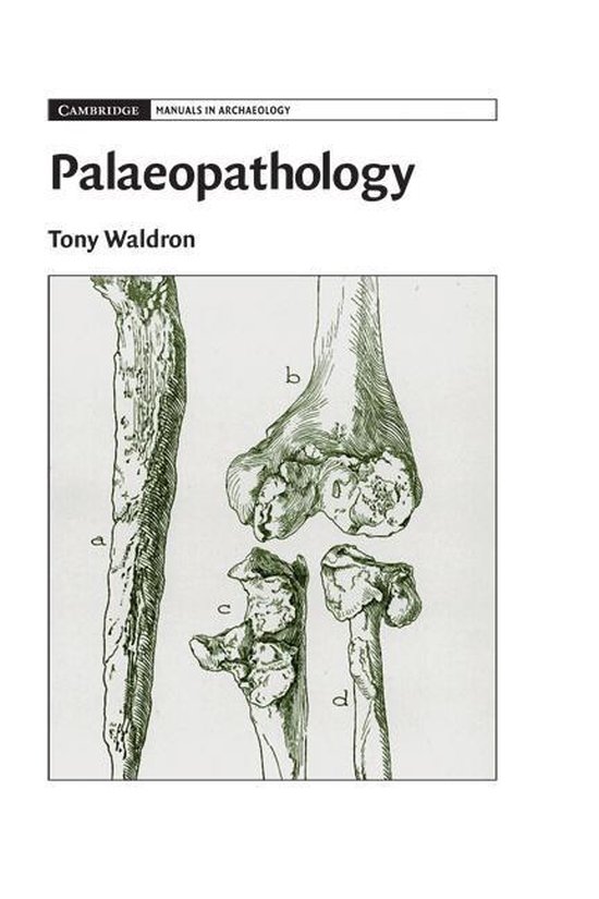 Cambridge Manuals in Archaeology - Palaeopathology - cover