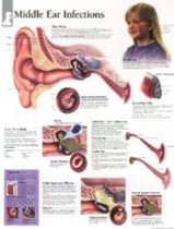 Middle Ear Infections Laminated Poster