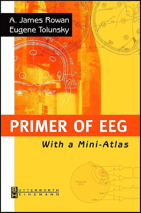 Primer of EEG 9780750674768 A.James Rowan Boeken