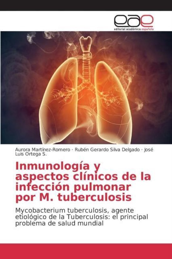Boek cover Inmunologia y aspectos clinicos de la infeccion pulmonar por M. tuberculosis van Martinez-Romero Aurora (Paperback)