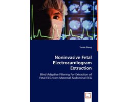Noninvasive Fetal Electrocardiogram Extraction
