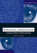 Iridologia-Irisdiagnose