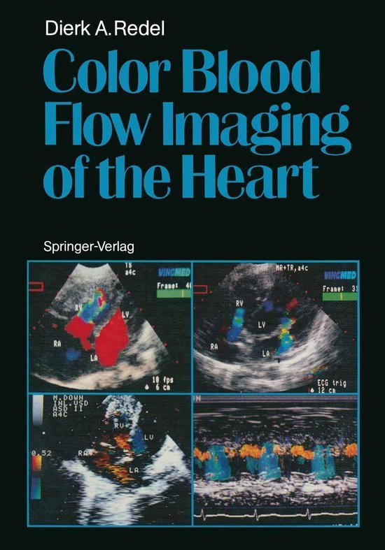 Medicine (R0) - Color Blood Flow Imaging of the Heart - cover
