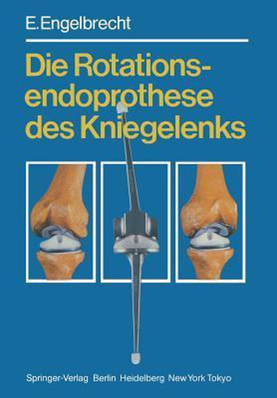Die Rotationsendoprothese Des Kniegelenks - cover