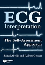 Ecg Interpretation