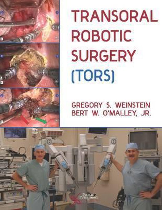 Transoral Robotic Surgery (TORS) - cover