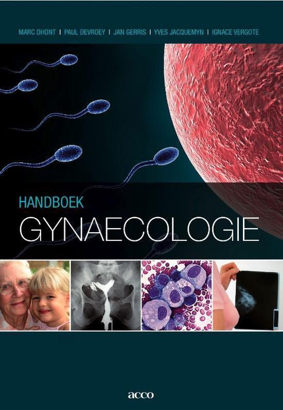 Handboek Gynaecologie - Marc Dhondt | Tiliboo-afrobeat.com