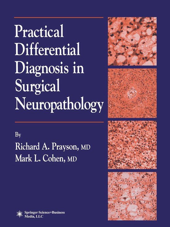 Practical Differential Diagnosis in Surgical Neuropathology (ebook