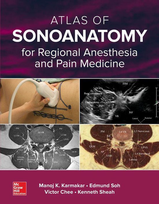 Atlas of Sonoanatomy for Regional Anesthesia and Pain Medici ... - cover