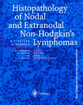 Histopathology of Nodal and Extranodal Non-Hodgkin S Lymphomas