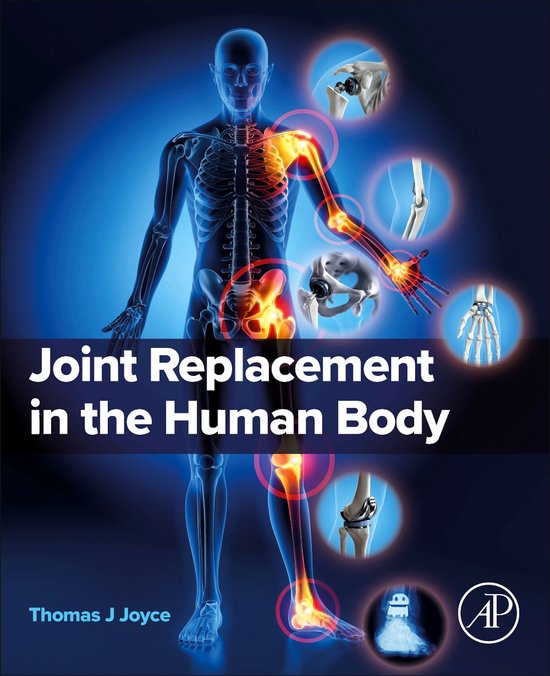 Joint Replacement in the Human Body - cover