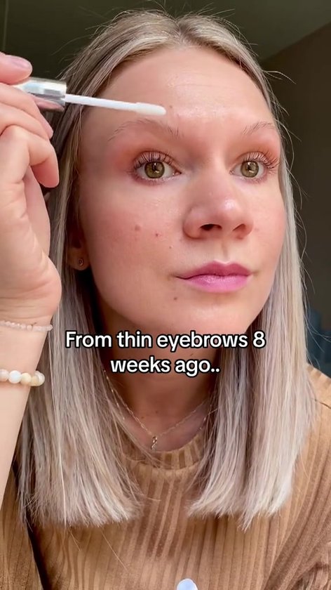 Feg Wenkbrauwserum Ervaringen: Wat Kun Je Realistisch Verwachten? Ontdek de Feiten!