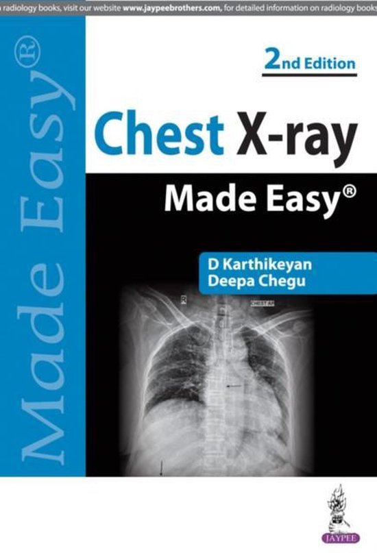 Chest Xray Made Easy 9789350255636 D. Karthikeyan Boeken