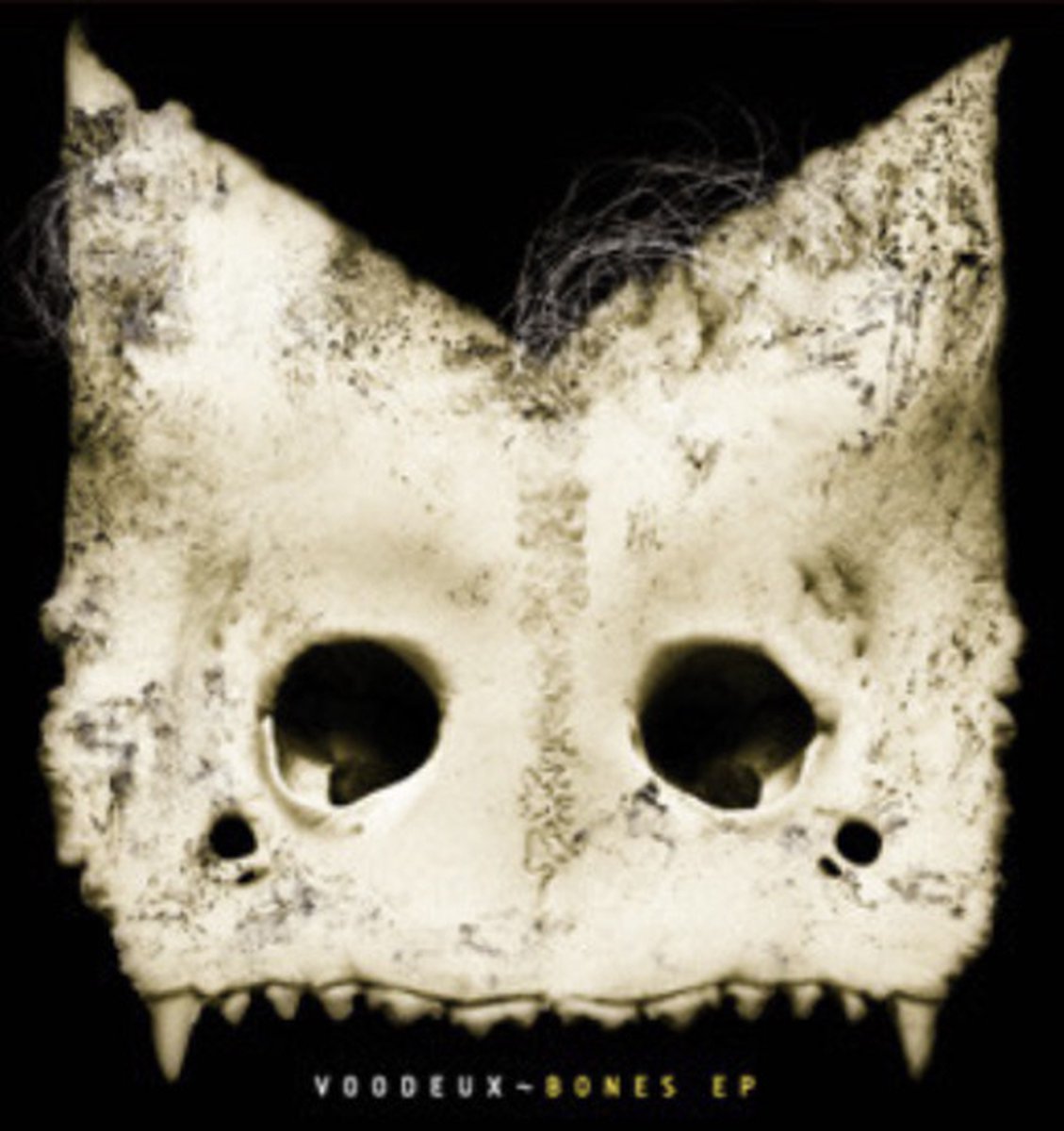 Bones