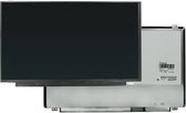 15.6 inch LCD Scherm 3840x2160 Glans 40Pin eDP, IPS