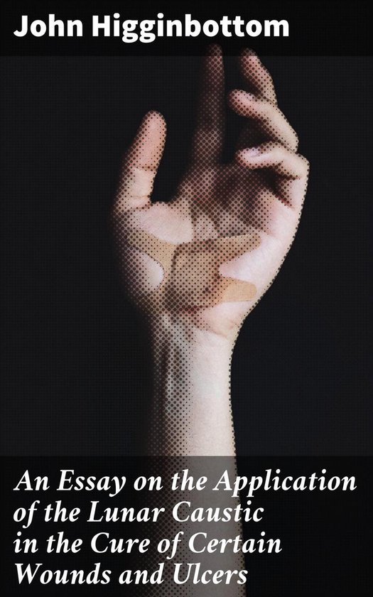 An Essay on the Application of the Lunar Caustic in the Cure ... - cover