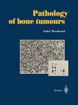 Pathology of bone tumours