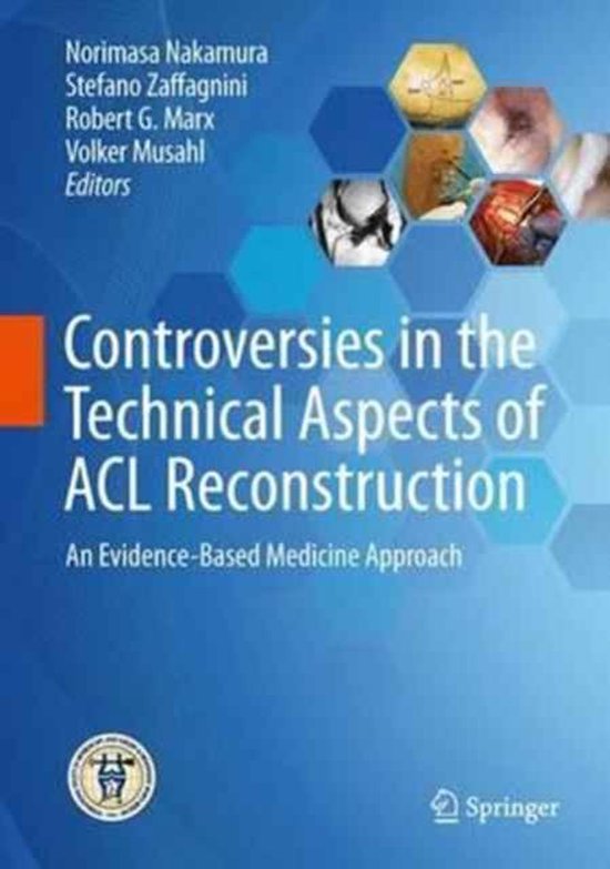 Controversies in the Technical Aspects of ACL Reconstruction - cover