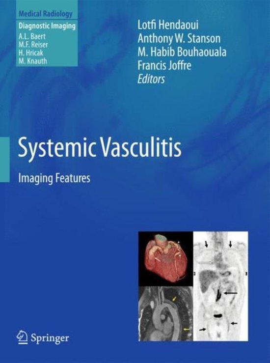 Systemic Vasculitis - cover