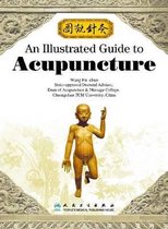 An Illustrated Guide to Acupuncture