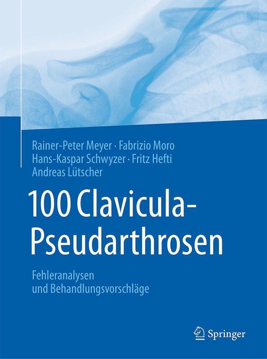 Medicine (German Language) - 100 Clavicula-Pseudarthrosen - cover