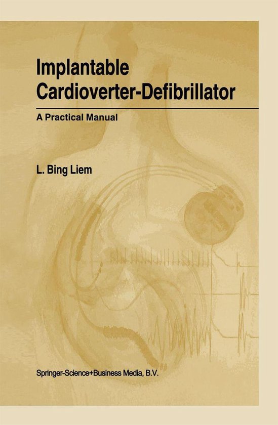 Foto: Implantable cardioverter defibrillator