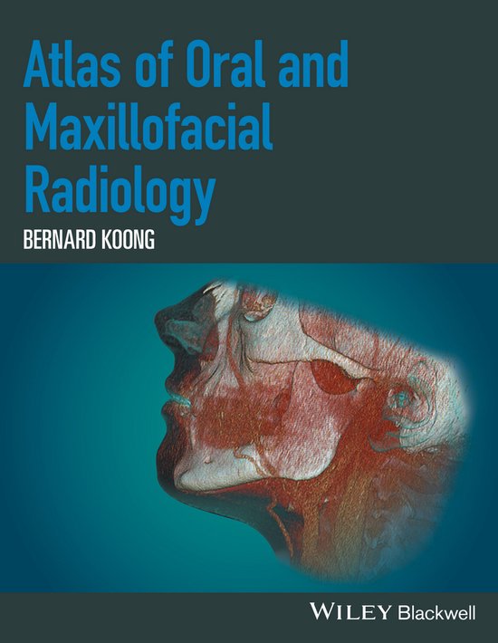 Atlas Of Oral & Maxillofacial Radiology 9781118939642 Bernard Koong Boeken bol
