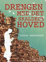 Drengen med det skaldede hoved