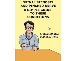 Spinal Stenosis And Pinched Nerve A Simple Guide to These conditions