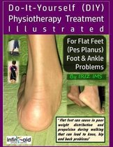 Iriz_self_help- Physiotherapy Treatment Illustrated For Flat Feet (Pes Planus) Foot & Ankle Problems