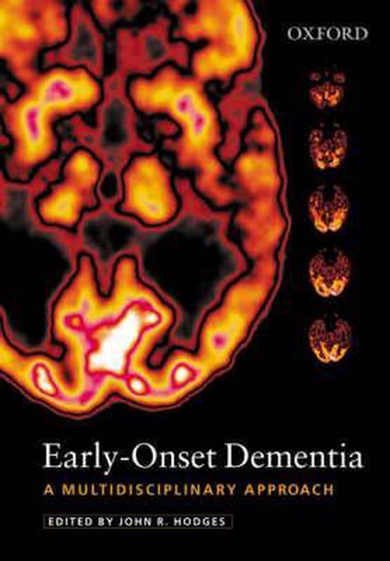 EarlyOnset Dementia 9780192630346 John R. Hodges Boeken