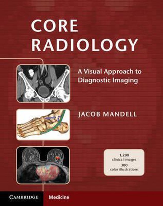 Livre 'Core Radiology' avec des images du bassin, du pied et d'un scanner mammaire.
