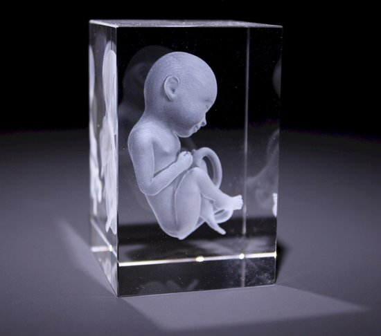 Anatomie model Foetus - 3D glazen blok - verpleegkundige cadeau/ dokter cadeau/ geneeskunde cadeau / verloskunde cadeau/ bedankje