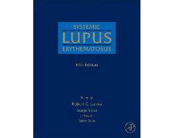 Systemic Lupus Erythematosus