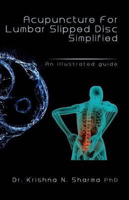Acupuncture for Lumbar Slipped Disc Simplified, Dr Krishna N Sharma 9781492737247