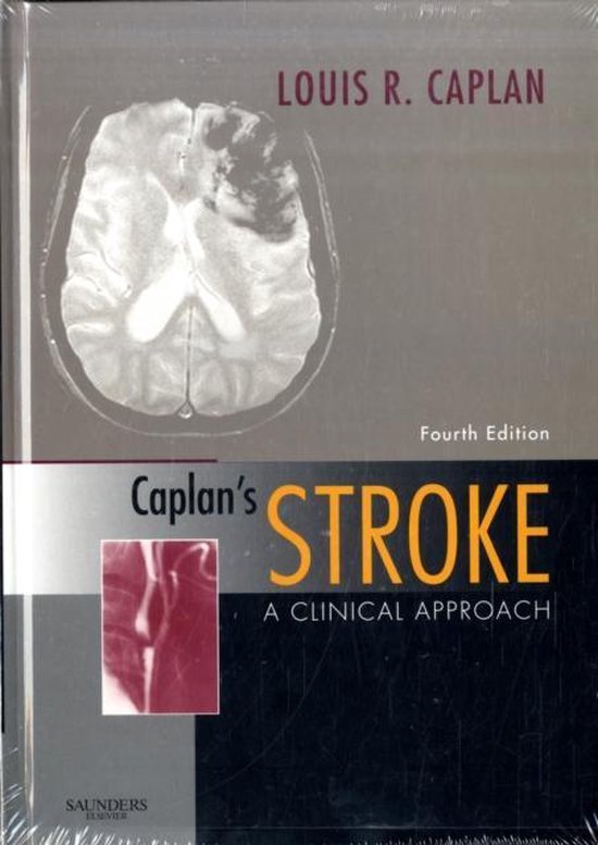 Caplan'S Stroke 9781416047216 Louis Caplan Boeken bol