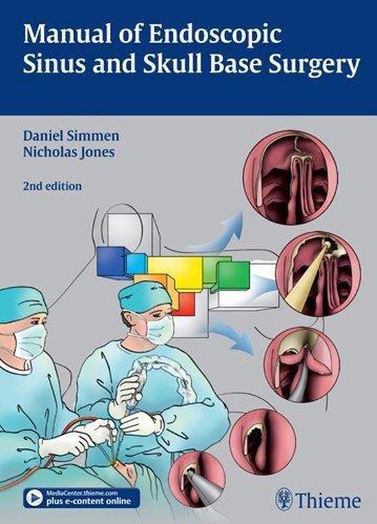 Manual Of Endoscopic Sinus And Skull Base Surgery: And Its E - cover
