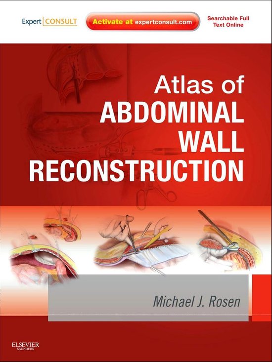 Atlas of Abdominal Wall Reconstruction - cover