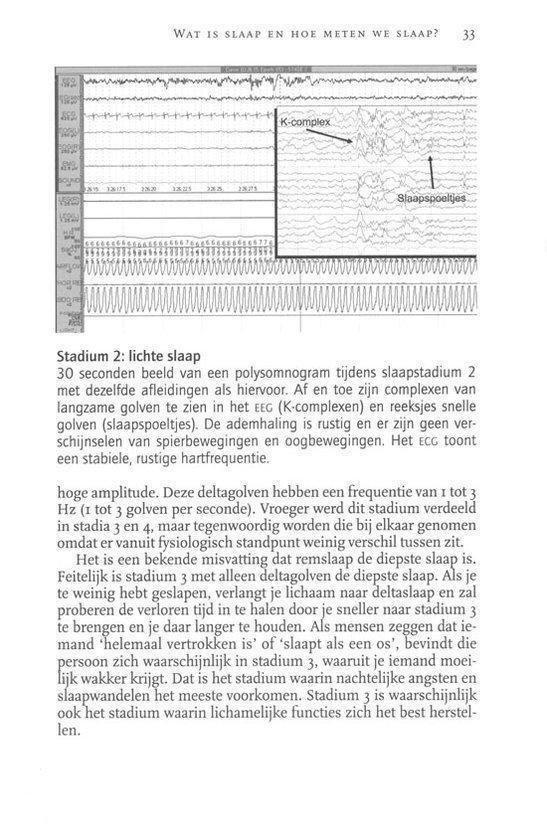 Slaap & Slaapstoornissen