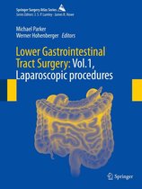 Springer Surgery Atlas Series - Lower Gastrointestinal Tract Surgery: Vol.1, Laparoscopic procedures